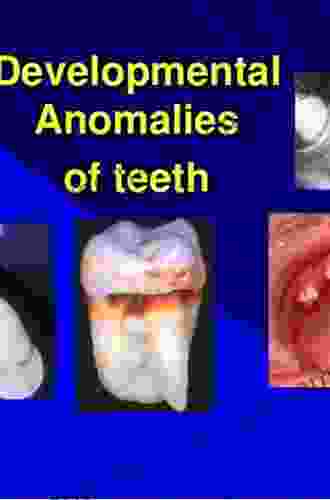 Anomalies Of The Developing Dentition: A Clinical Guide To Diagnosis And Management