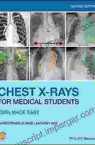 Chest X Rays For Medical Students: CXRs Made Easy