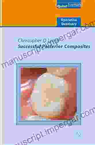 Successful Posterior Composites: Operative Dentistry 6 (QuintEssentials Of Dental Practice 32)